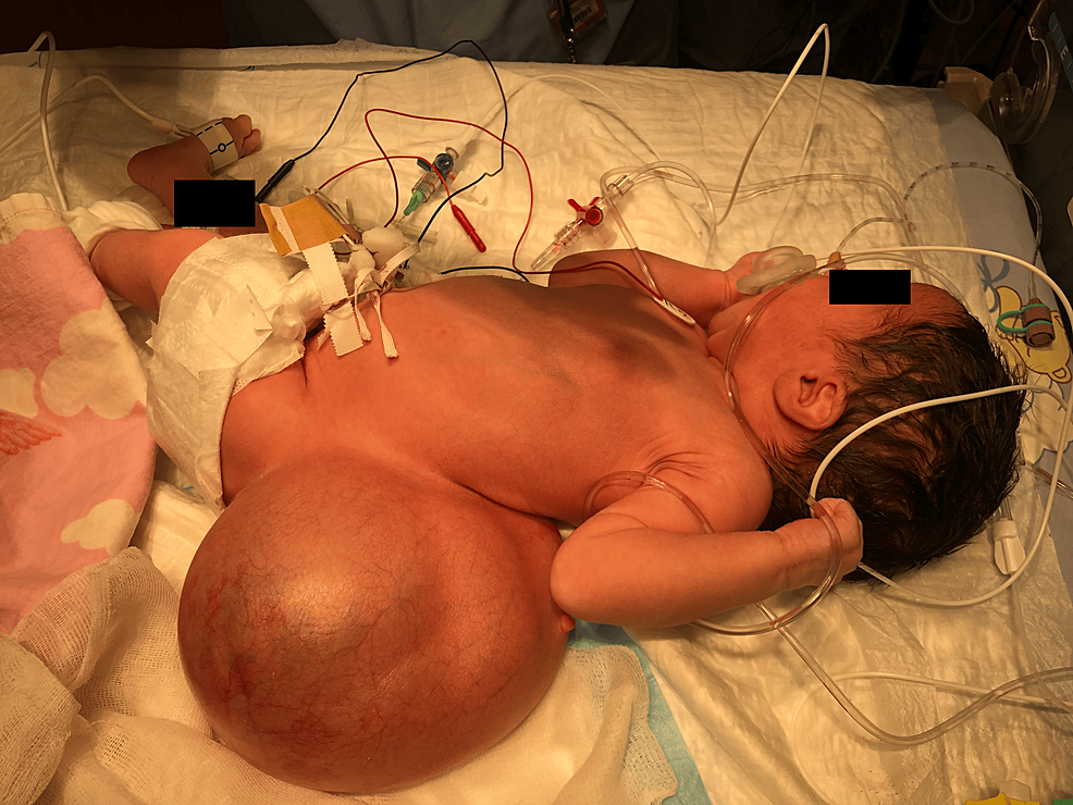 Newborn-in-supine-position