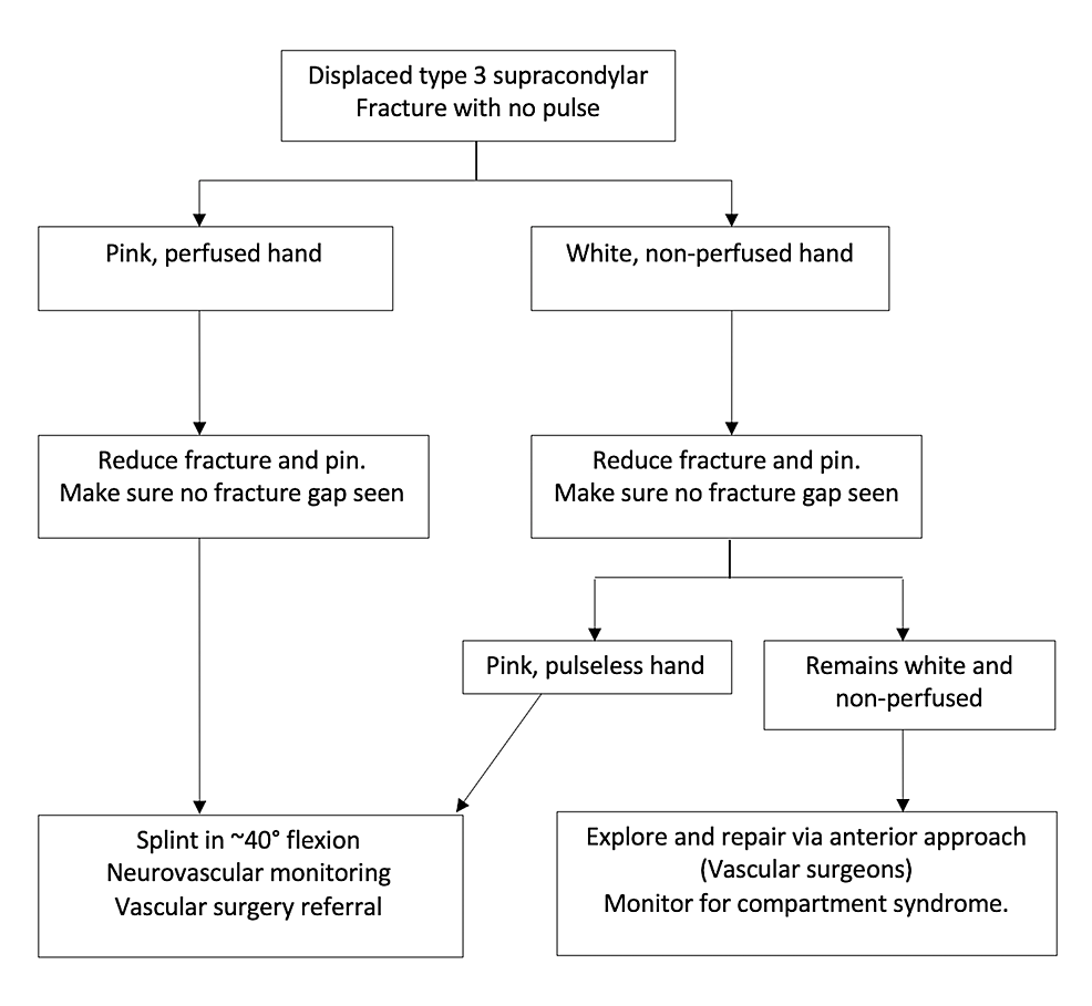 Cureus Current Management of Paediatric Supracondylar Fractures of