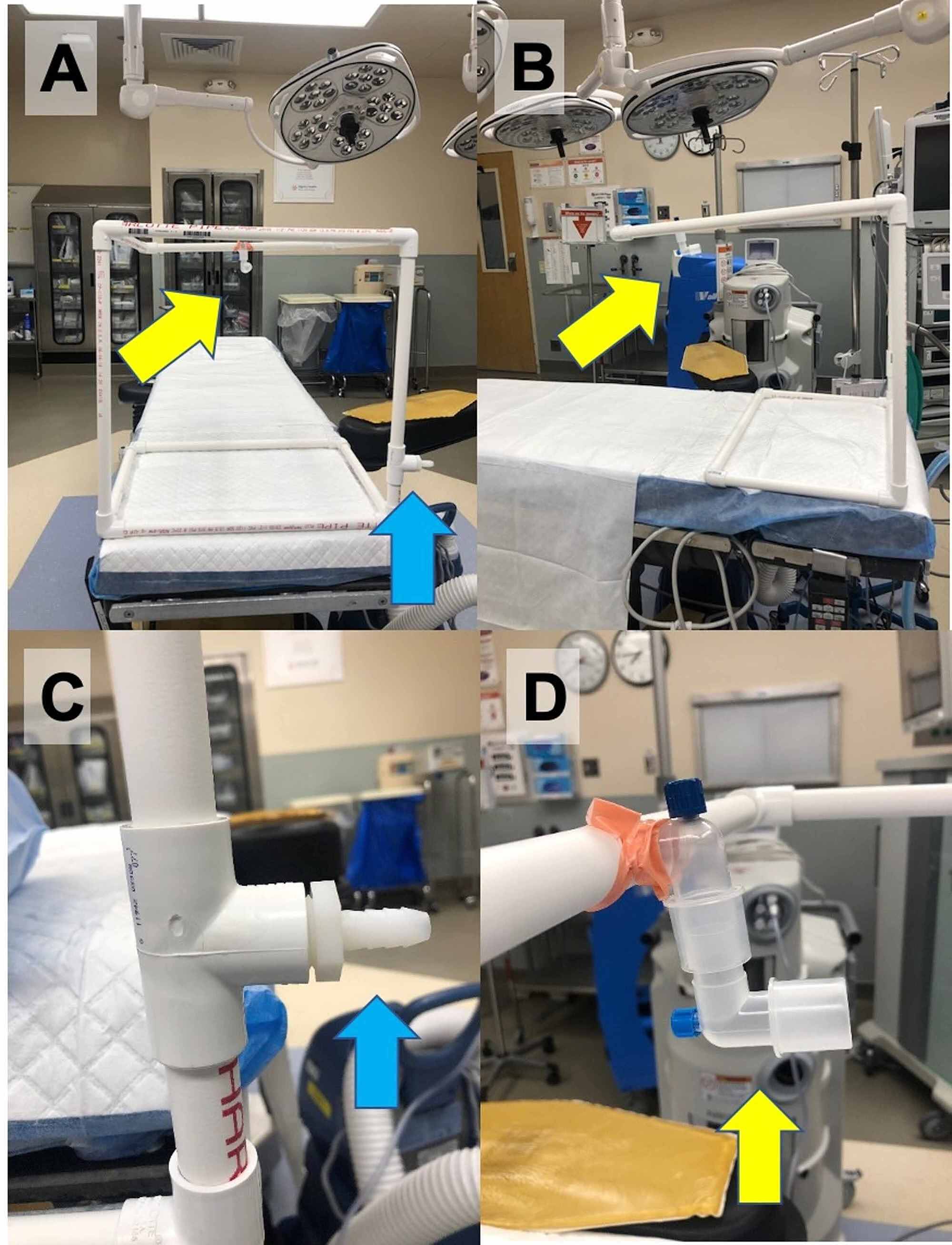 Cureus The Vacuum Assisted Negative Pressure Isolation Hood (VANISH
