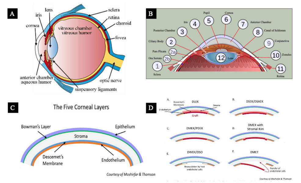 Evaluación de modelos de inteligencia artificial generativa (IA) en la creación de ilustraciones médicas para diversos procedimientos de trasplante de córnea