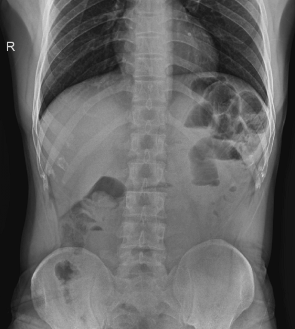 IR様 106r03690-1000x1000.jpg