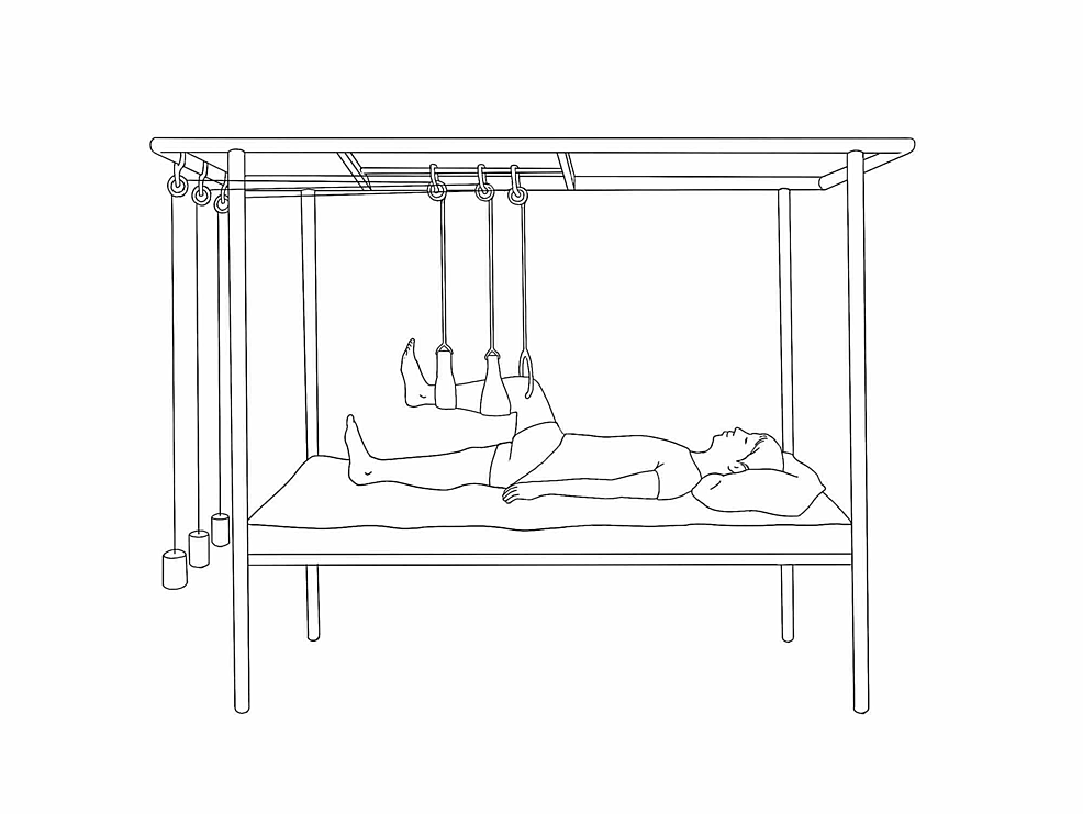 Cureus Keeping the Traction on in Orthopaedics