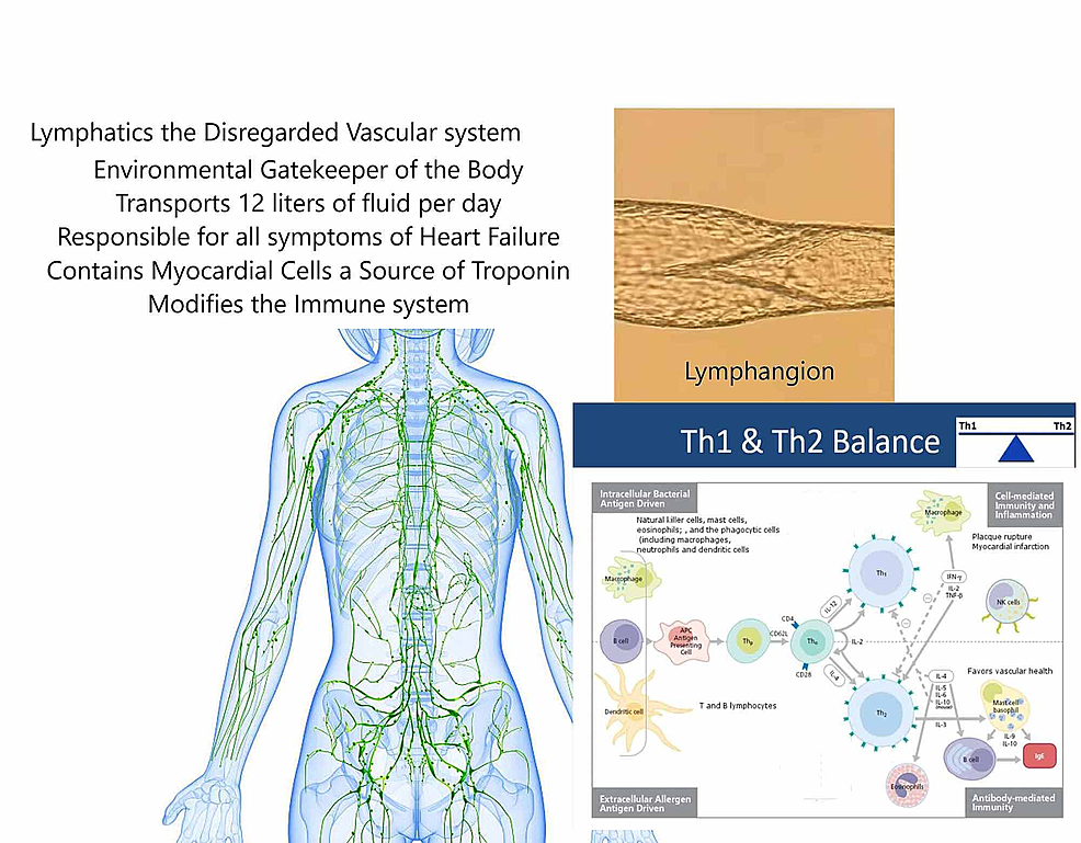 Cureus | Why We Fail at Heart Failure: Lymphatic ...
