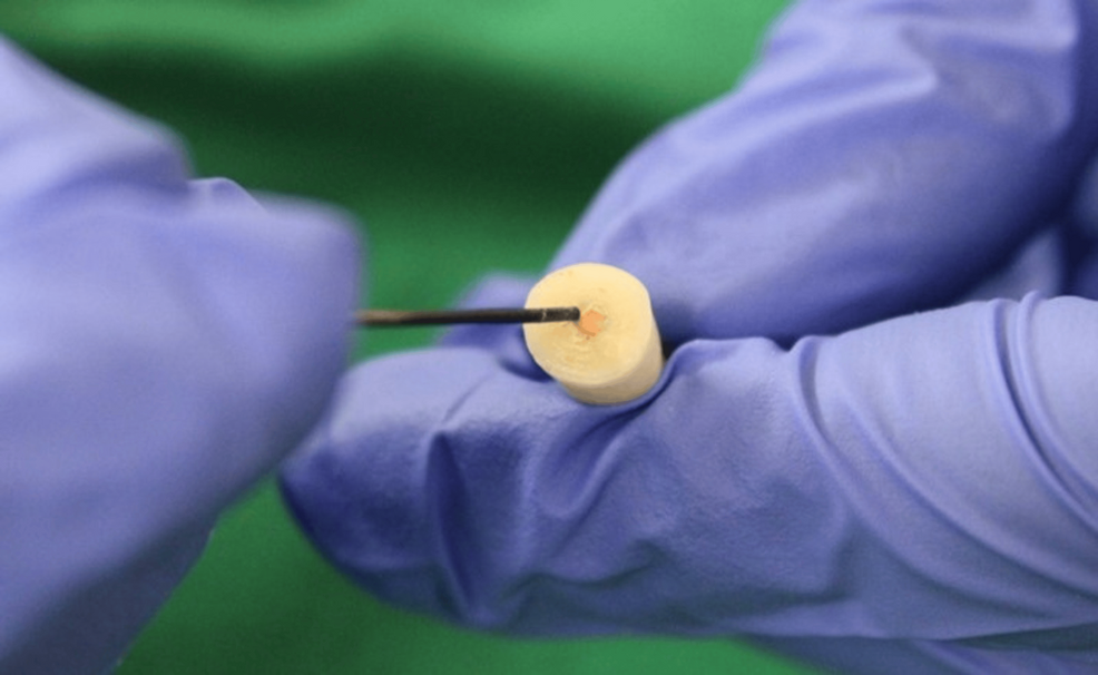 lke Effect of Newer Intraorifice Barriers on the Fracture Resistance