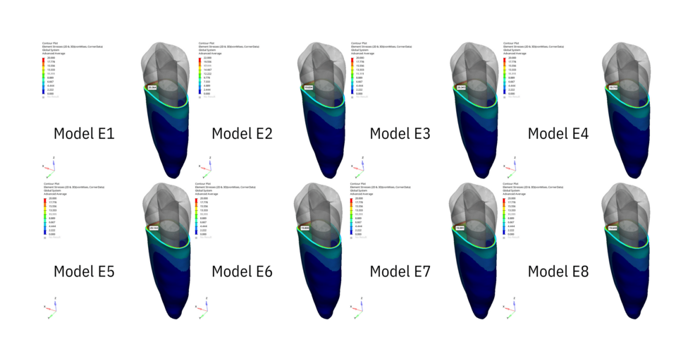 Evaluating the Restoration of External Root Resorption Under ...