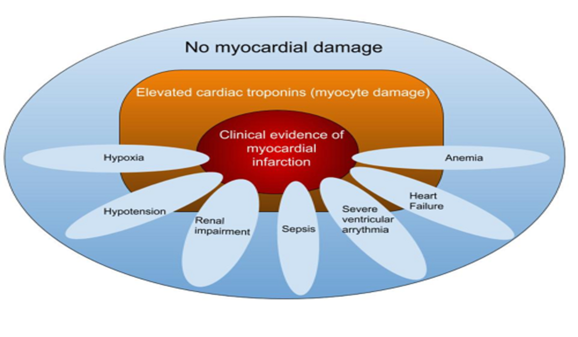 cureus-type-ii-myocardial-infarction-predisposing-factors