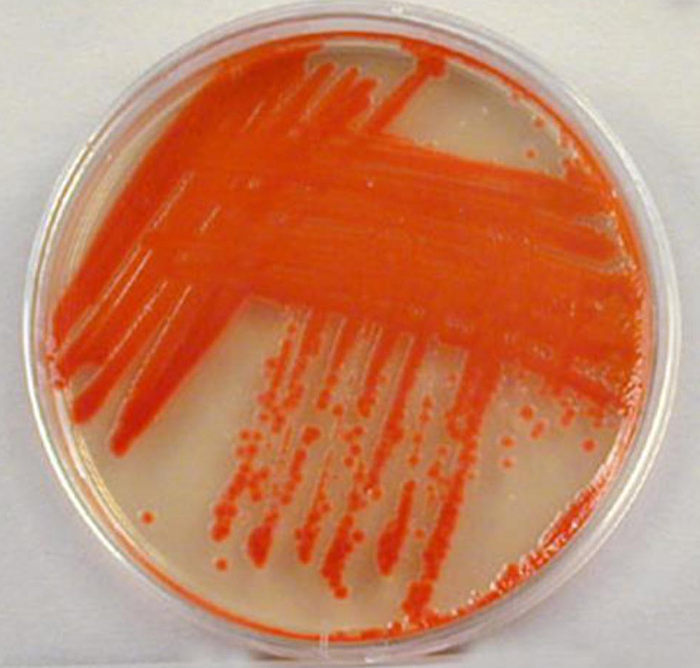 Serratia Marcescens Nutrient Agar