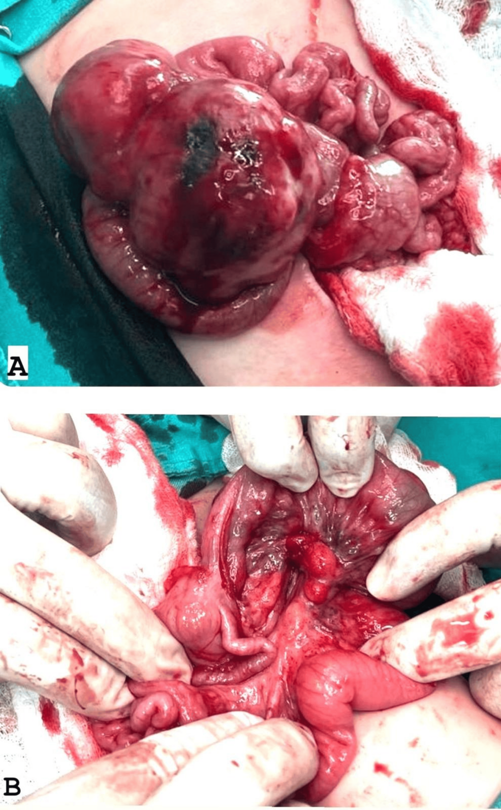 Intraoperative-images- Intraoperative-images-