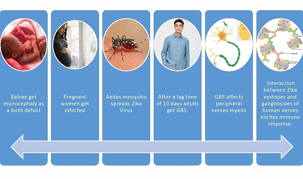 The Association of AntiGanglioside Antibodies in the Pathogenesis and