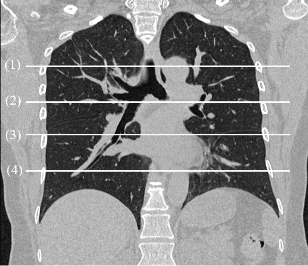 Quantitative Assessment of Postural Influence on Lung Function