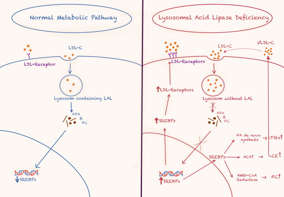 Lysosomal Acid Lipase Deficiency: A Report of Two Cases and a Review of the  Literature