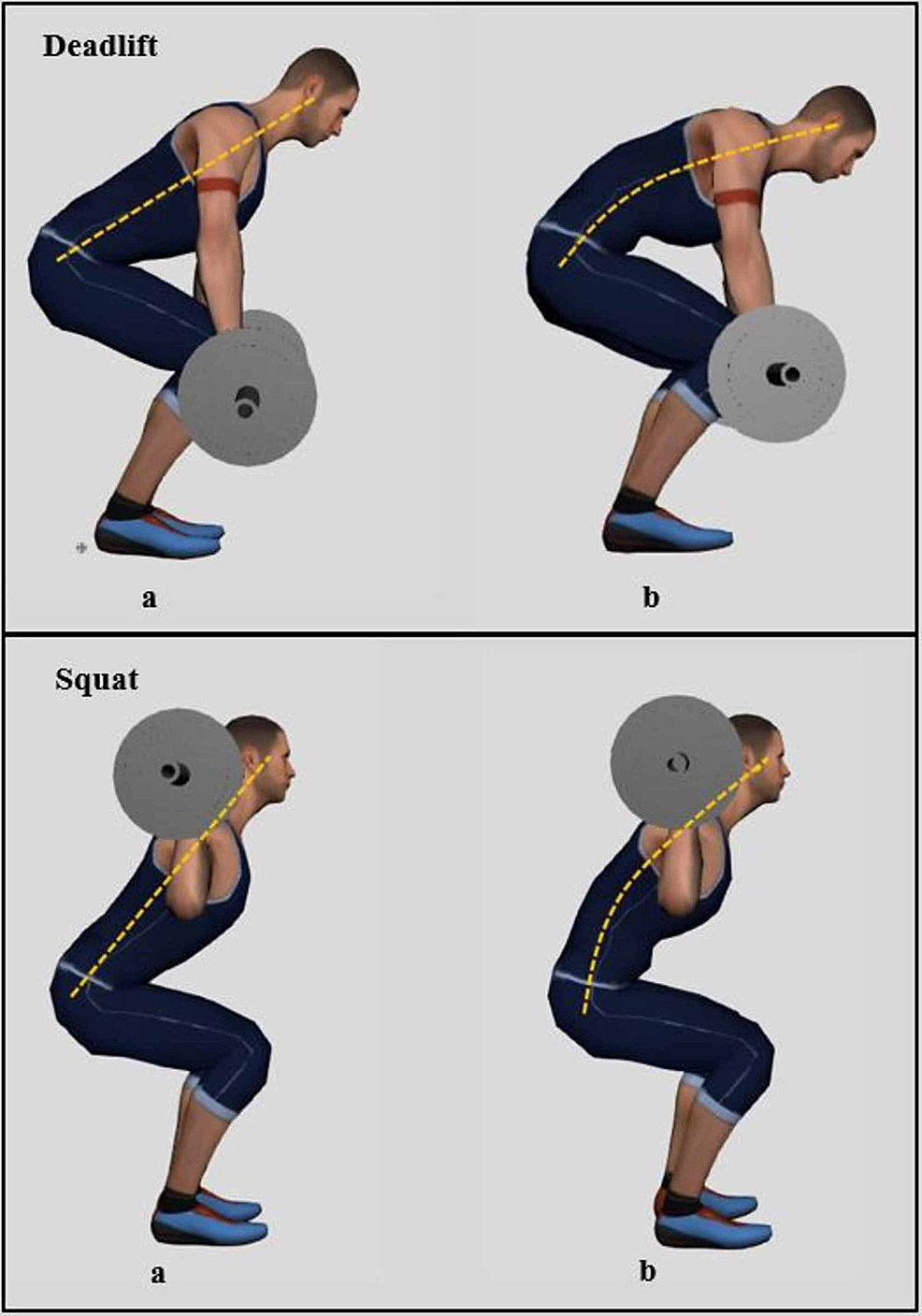 Cureus Low Back Pain Among Weightlifting Adolescents and Young Adults
