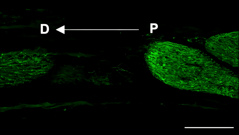 Immunohistochemistry-of-S100β-in-the-inferior-alveolar-nerve-from-the-saline-group