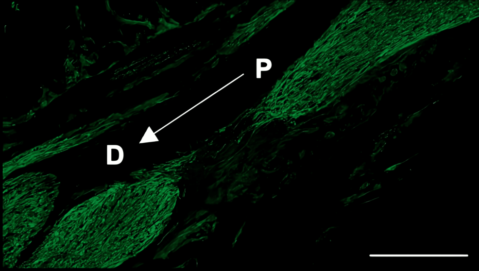 Immunohistochemistry-of-S100β-in-the-inferior-alveolar-nerve-from-the-FTY720-group