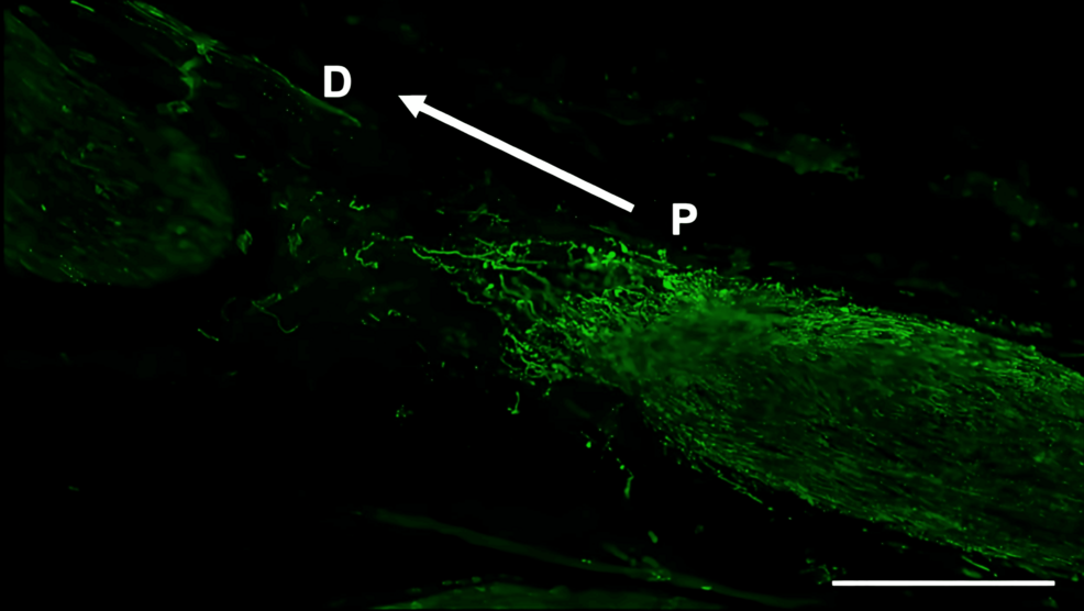 Immunohistochemistry-of-β3-tubulin-in-the-inferior-alveolar-nerve-from-the-saline-group