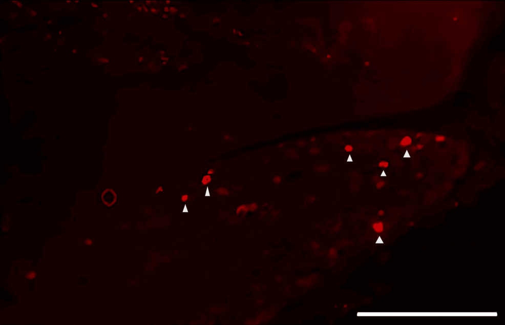 Fluorescence-image-of-neuronal-tracer-DiI-positive-neurons-in-the-trigeminal-ganglion-from-the-saline-group