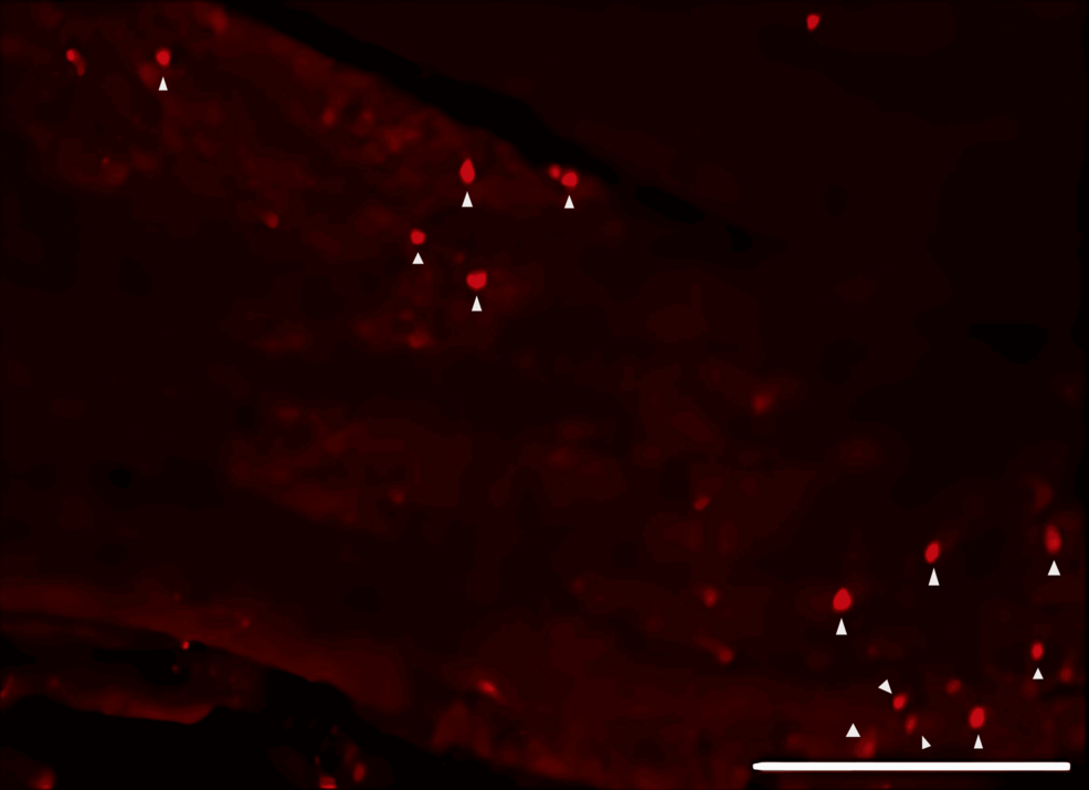 -Fluorescence-image-of-neuronal-tracer-DiI-positive-neurons-in-the-trigeminal-ganglion-from-the-FTY720-group