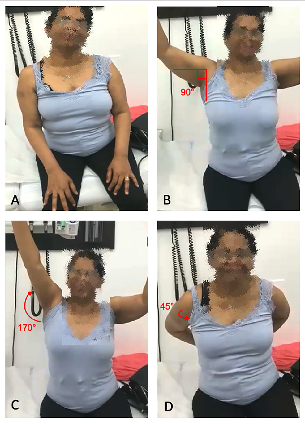 Cureus Use of Osteopathic Manipulation for Treatment of Chronic