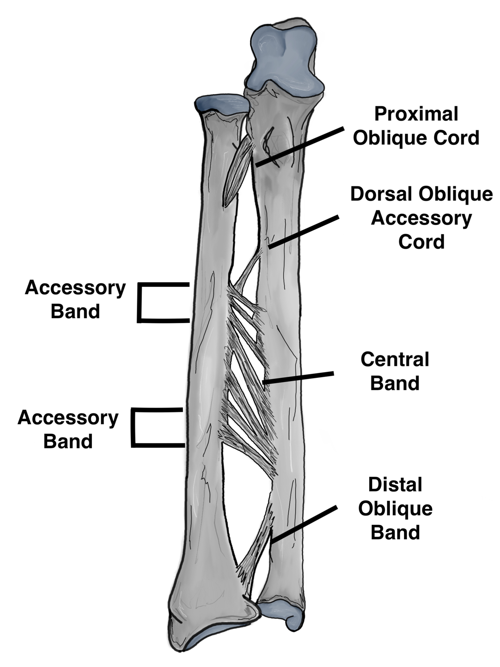 galeazzi fracture diagram