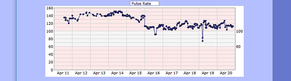 Case-1-pulse-from-April-11,-2020,-to-April-20,-2020-(bpm)