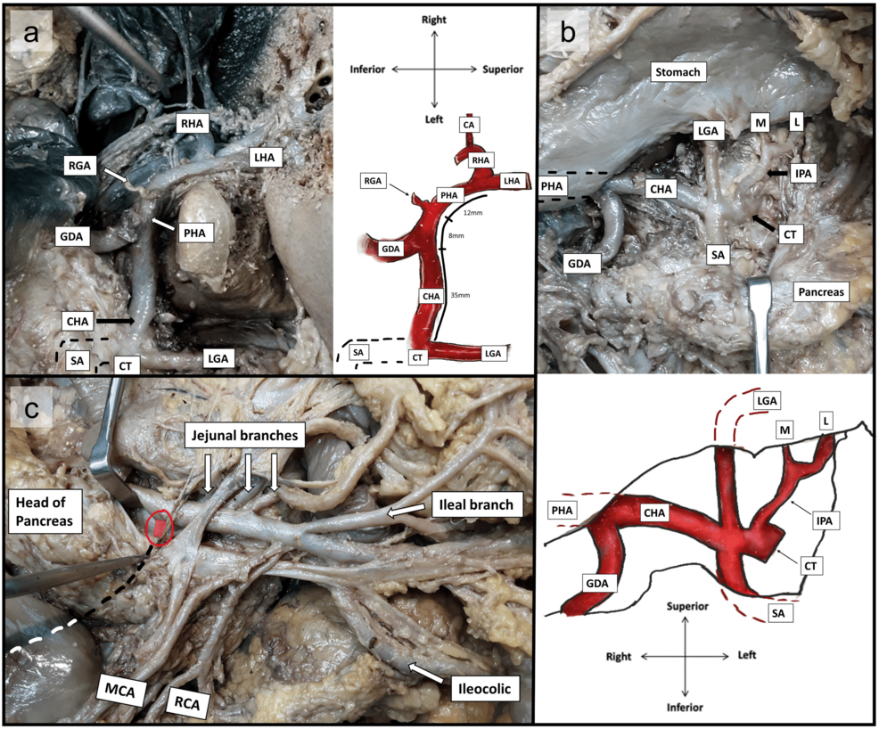 Pancreas: Anatomy, functions, blood supply, innervation | Kenhub, image size:986x818