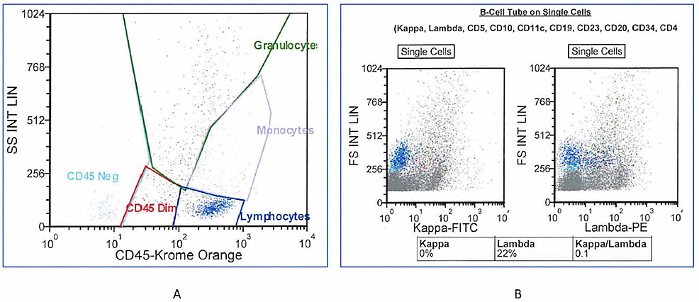 Flow-cytometry-characterizing-cells-of-the-pericolic-lymph-nodes-(A)-and-their-kappa-and-lambda-ratio-(B).