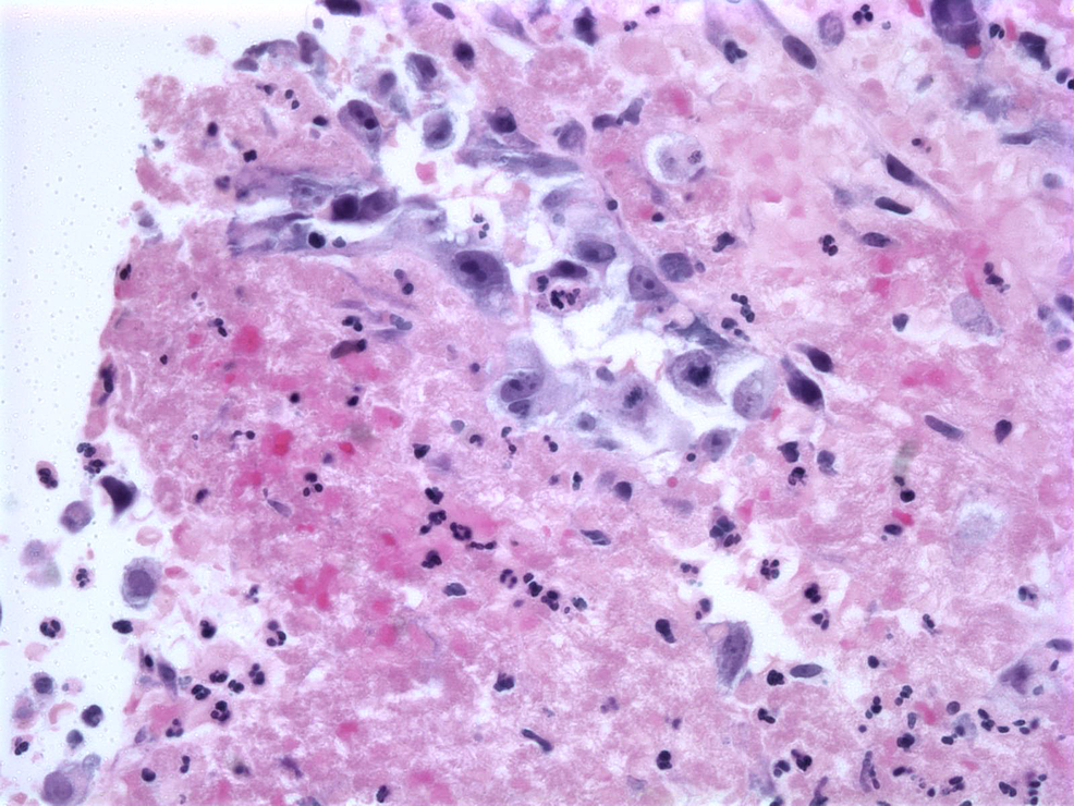 Hematoxylin-and-Eosin-Stained-Core-Liver-Biopsy-(40x)