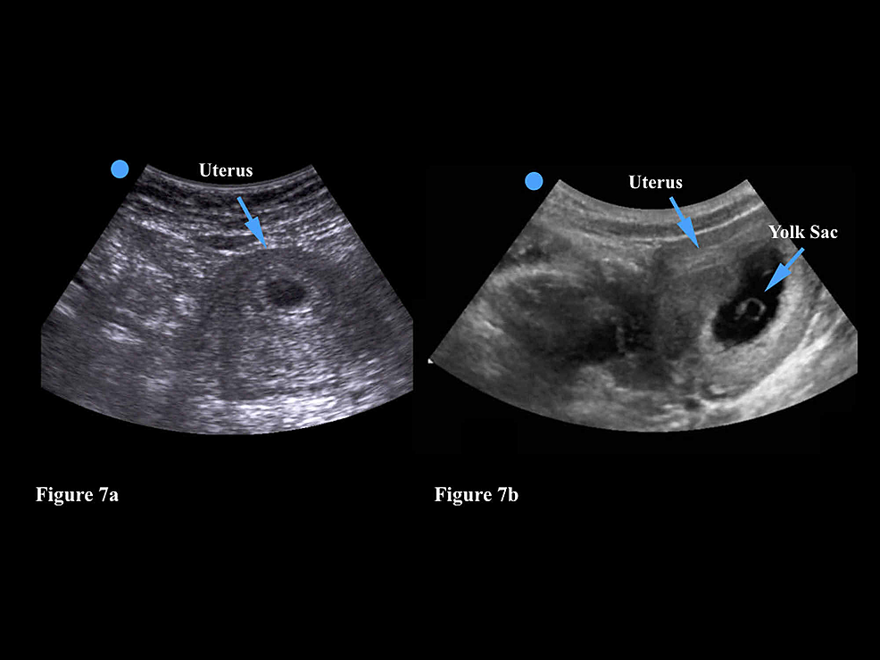 Cureus | Application of Point-of-Care Ultrasound for Family Medicine ...