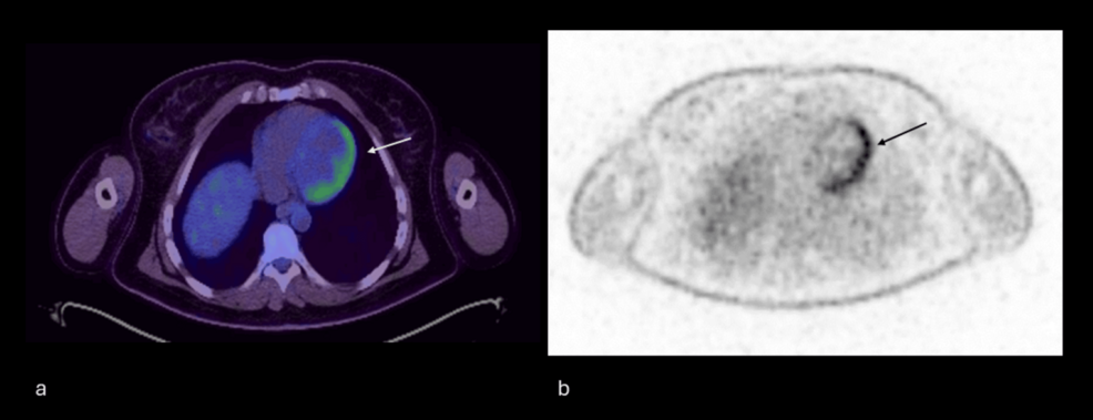 PET-CT-images. PET-CT-images.
