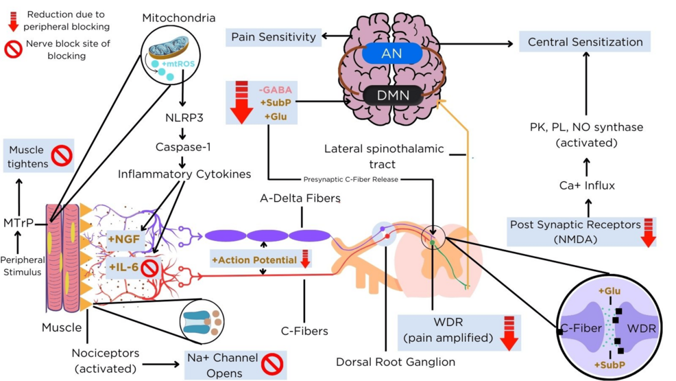 glutathione and fibromyalgia High-Frequency Accessory Transcapular Nerve Blocks in the Management of Fibromyalgia: A Case Report toner for melasma Type:BPC+PEA 500 (30 Capsules) BPC 157 Gut Healing: