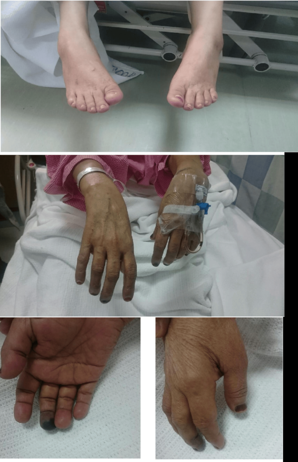 glutathione iv drip toronto Glutathione IV Therapy in Colorado