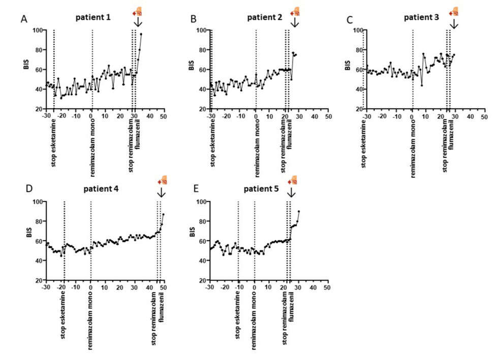 BIS-values-in-switching-and-antagonizing
