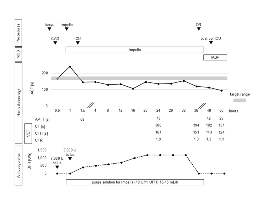Perioperative-time-course-regarding-Impella-management-and-heparin-anticoagulation Perioperative-time-course-regarding-Impella-management-and-heparin-anticoagulation