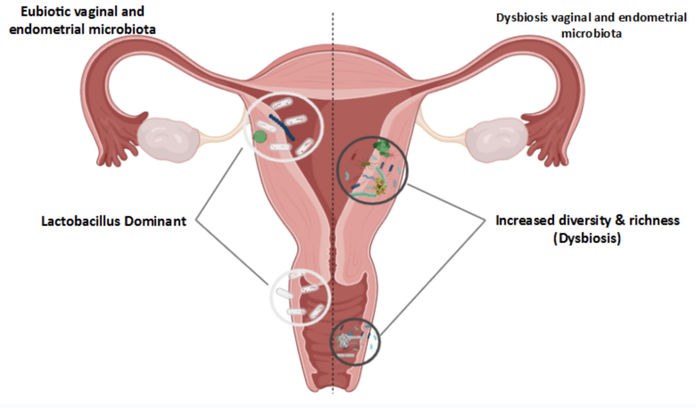 テスト Expert Opinion: Place in Therapy of Probiotics in Infertility and