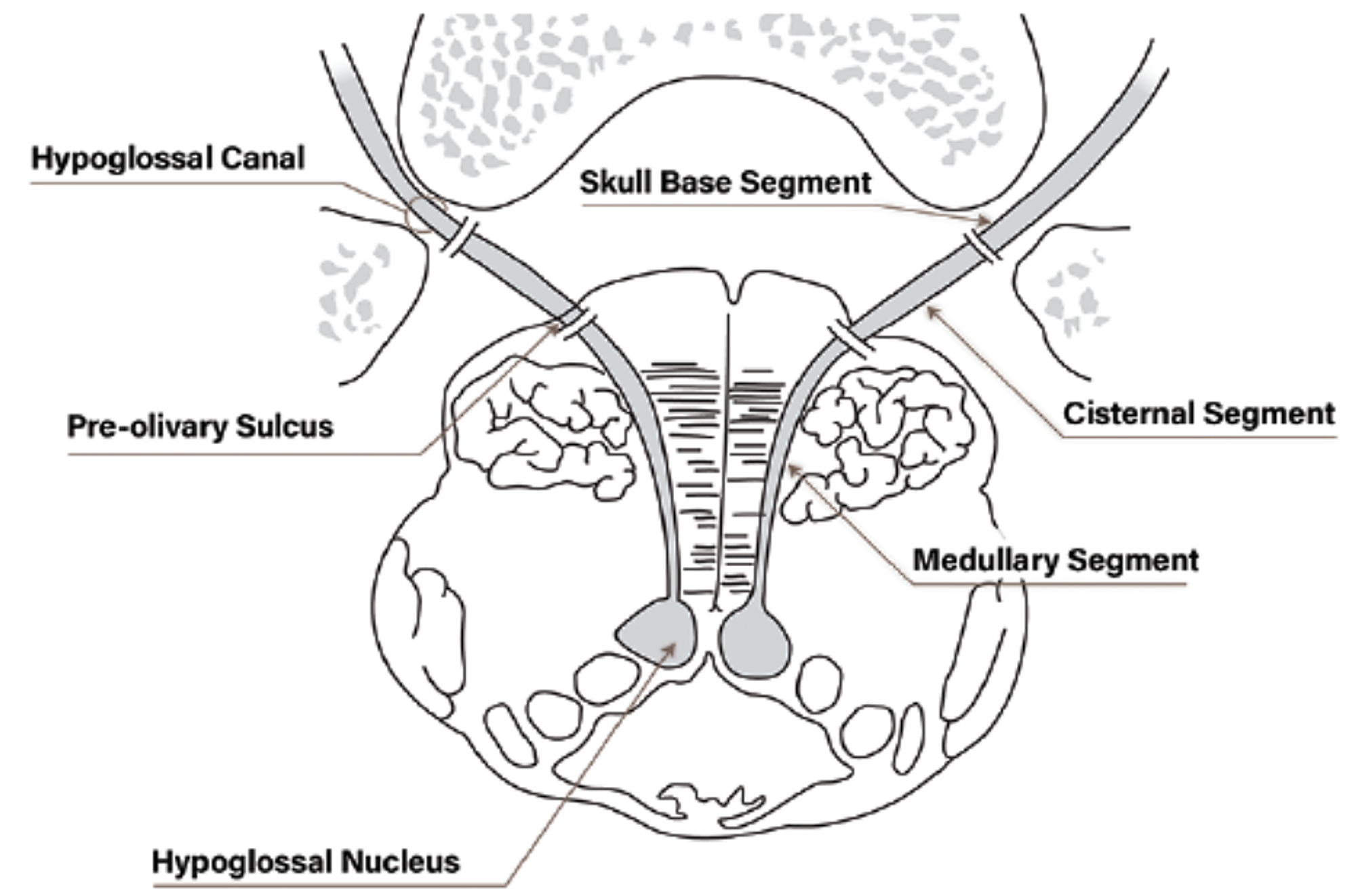 Cureus | Isolated Palsy of the Cisternal Segment of the Hypoglossal ...