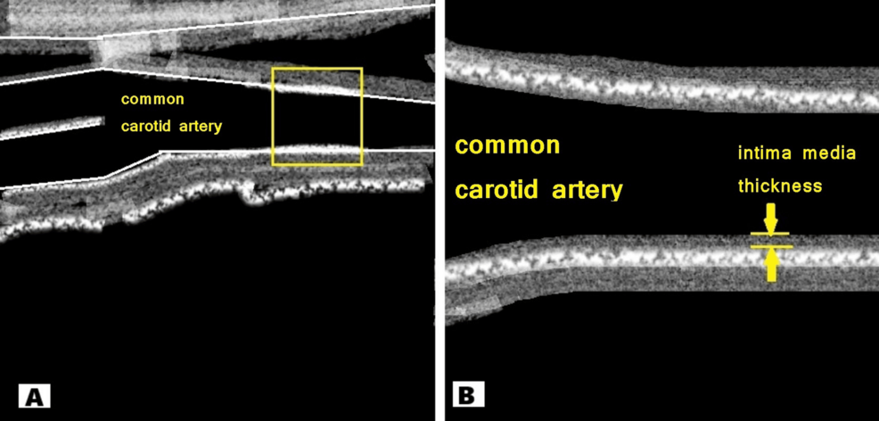Er-xotinning trannyni taklif qilayotgani haqidagi onlayn porno videolarni tomosha qiling Jinsiy tinglash video
