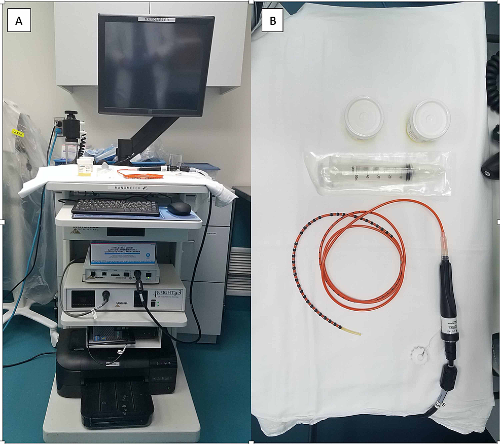 Cureus Roth NetAssisted EndoscopicGuided Manometry Catheter Placement
