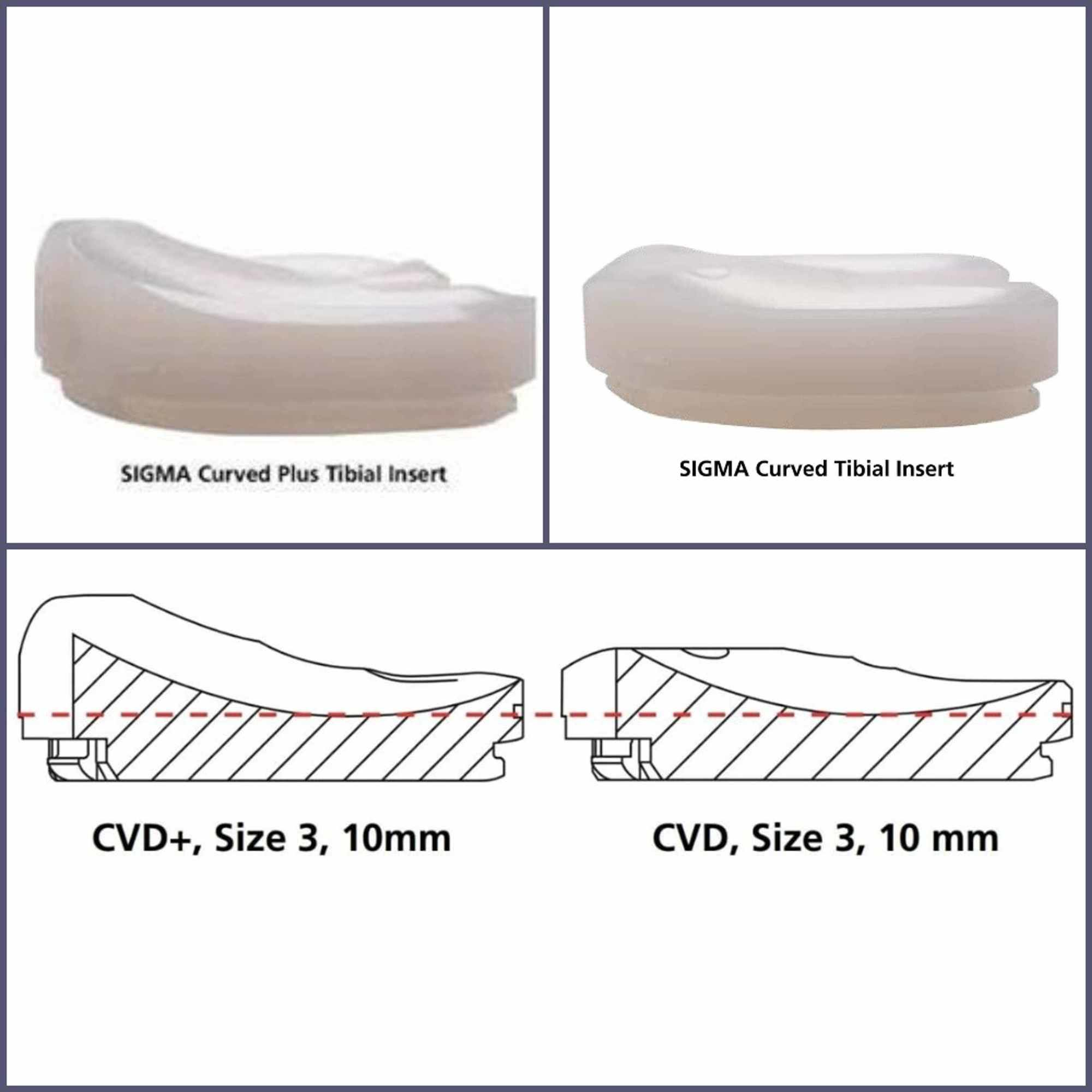 Cureus Clinical, Functional, and Midterm Survival Analysis on Sigma
