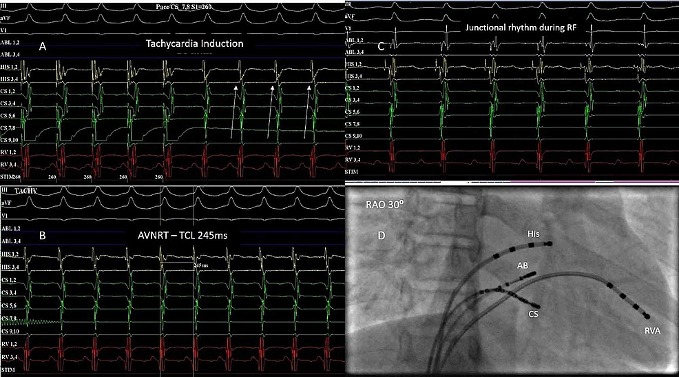 Cureus Safety, Efficacy, and IntermediateTerm of