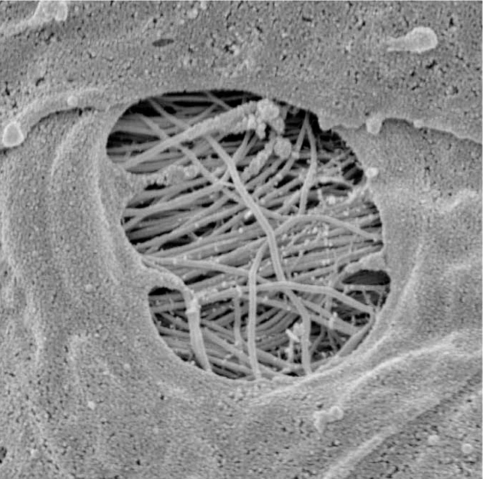The-image-shows-a-pore-or-stomata-of-a-vessel-in-the-subarachnoid-space-in-which-the-CSF-can-penetrate-into-the-perivascular-space.
