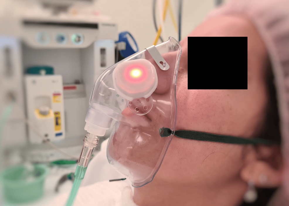 ApnoLight-shown-attached-to-the-exterior-of-the-oxygen-face-mask-overlapping-the-ventilation-holes,-flashing-red-to-indicate-an-apneic-event