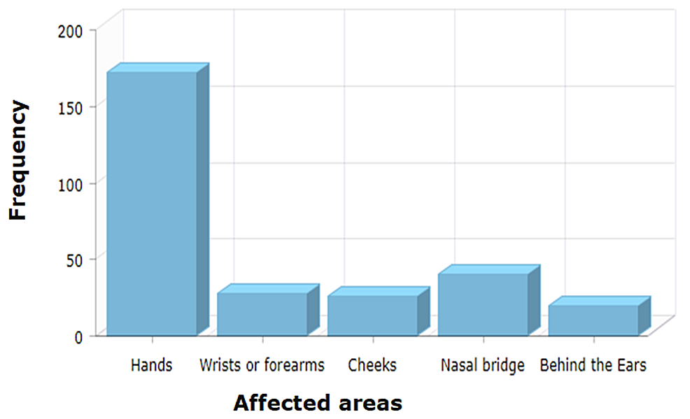 Frequency-of-the-affected-areas