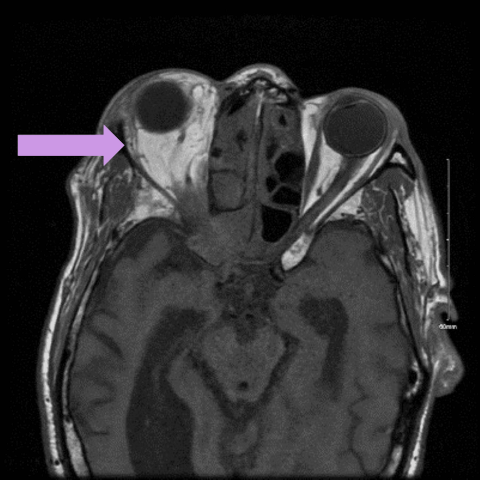 cyanosis様 DCX antibody (13925-1-AP) | Proteintech