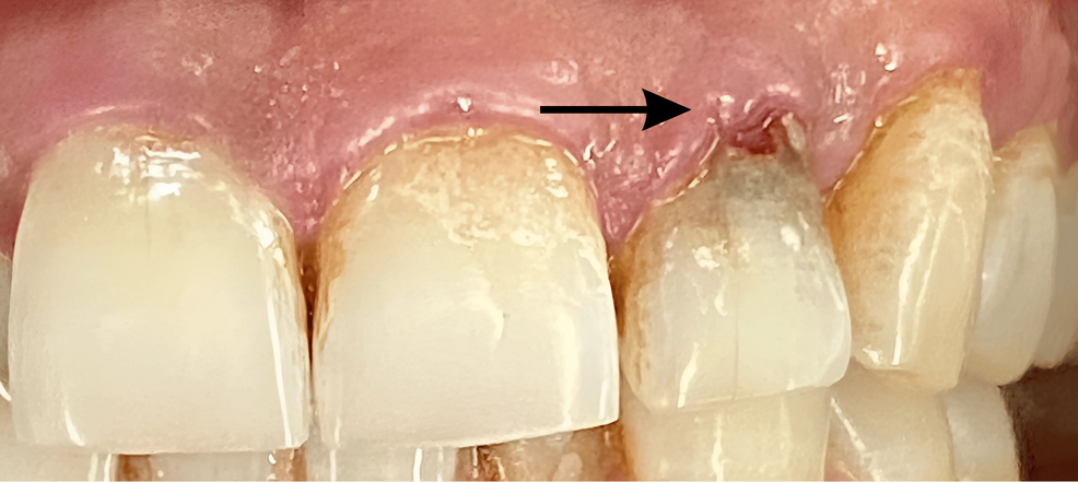 mimi 400Z's build thread | Ninja 400 Riders Forum