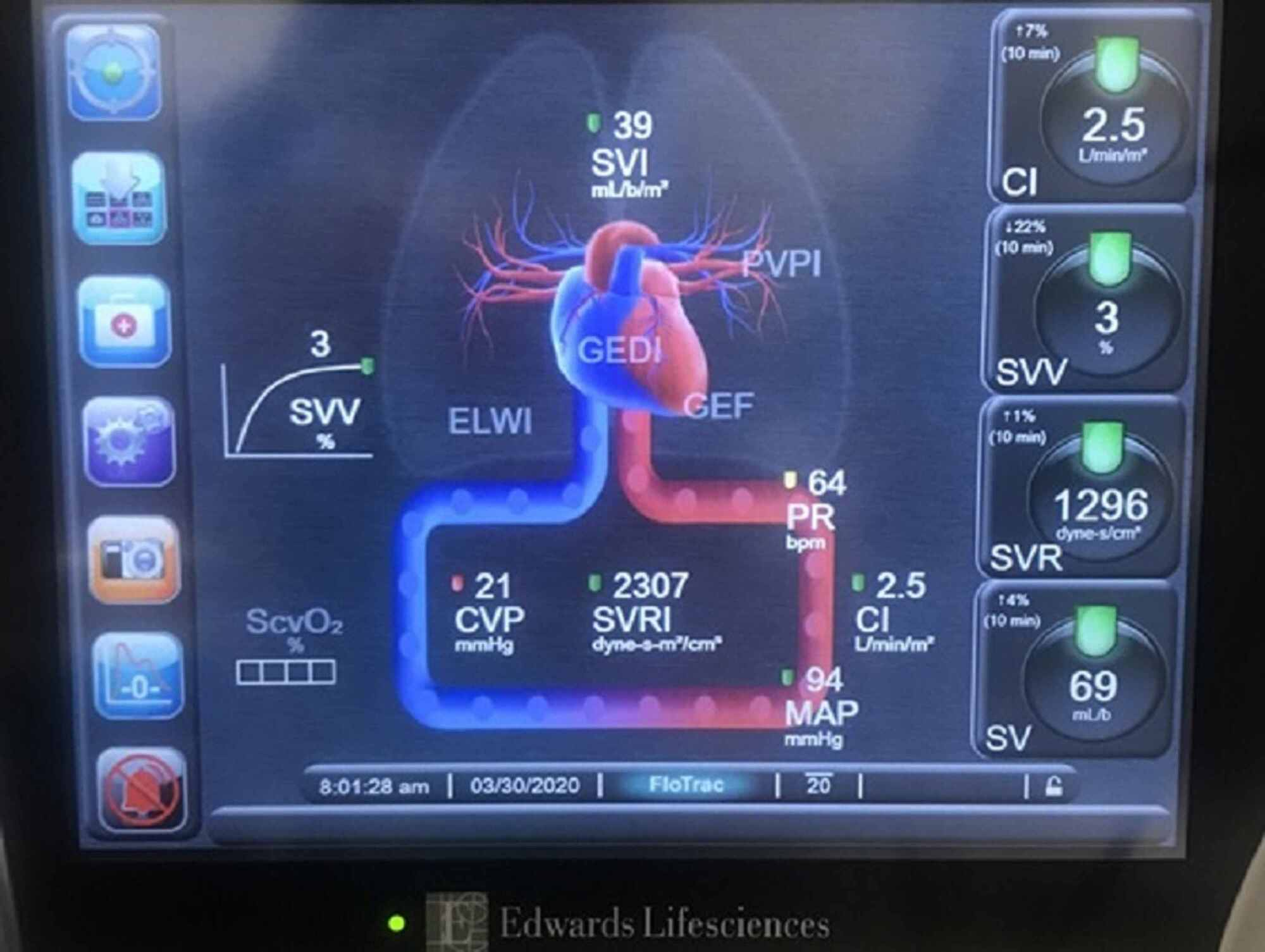 What Is The Best Definition Of Hemodynamic Instability