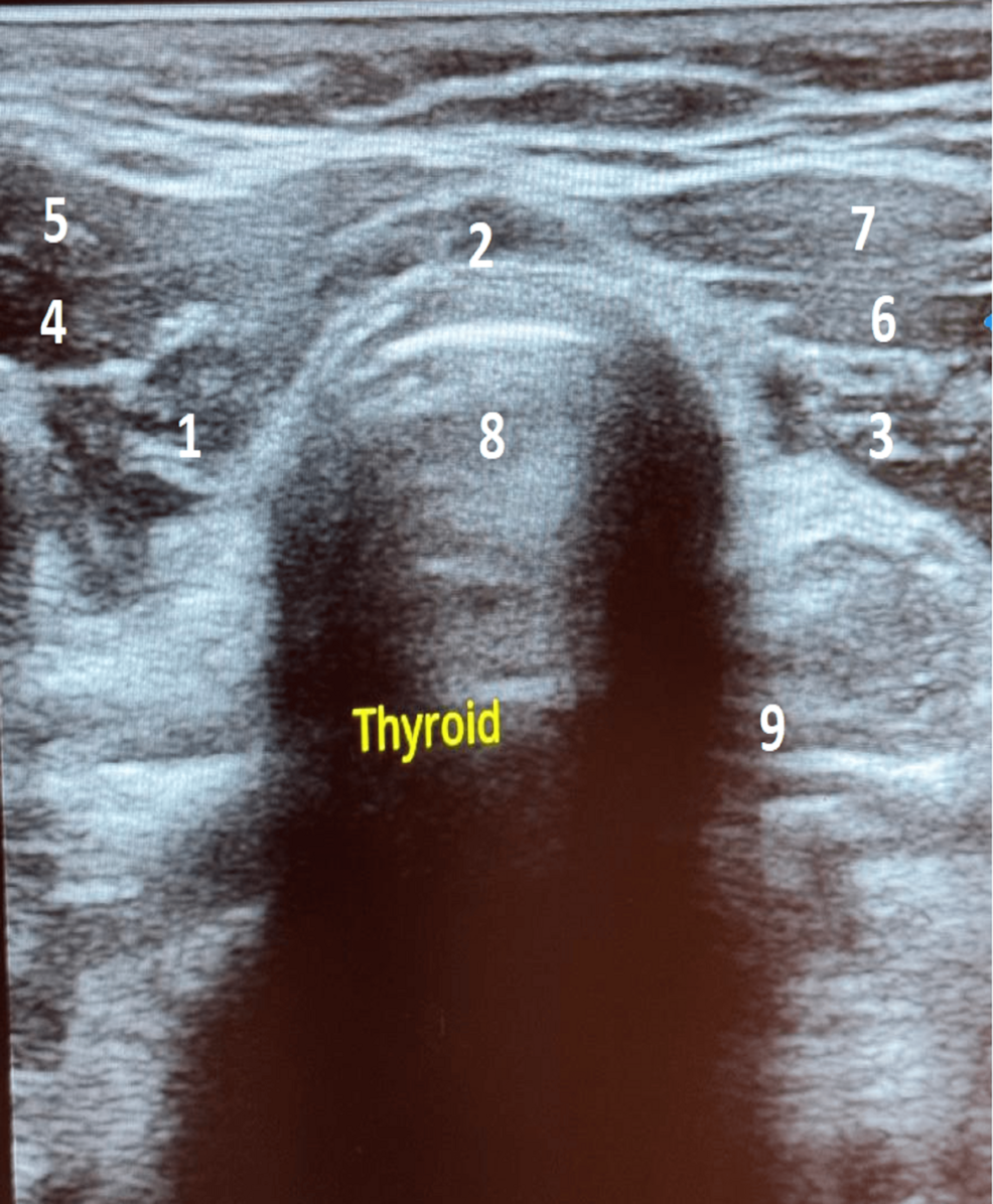 l carnitine thyroid reddit Acute Rhabdomyolysis as a Rare Manifestation of Hypothyroidism: A Case Report and Literature Review skin revitalizing Liposomal Copper GHK | Flavor:Tangy Orange