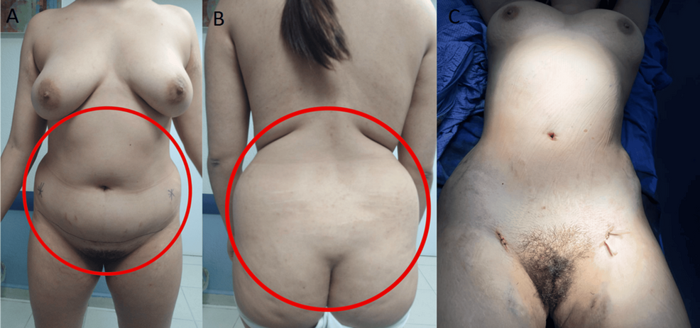 Preoperative-and-intraoperative-images-of-the-patient