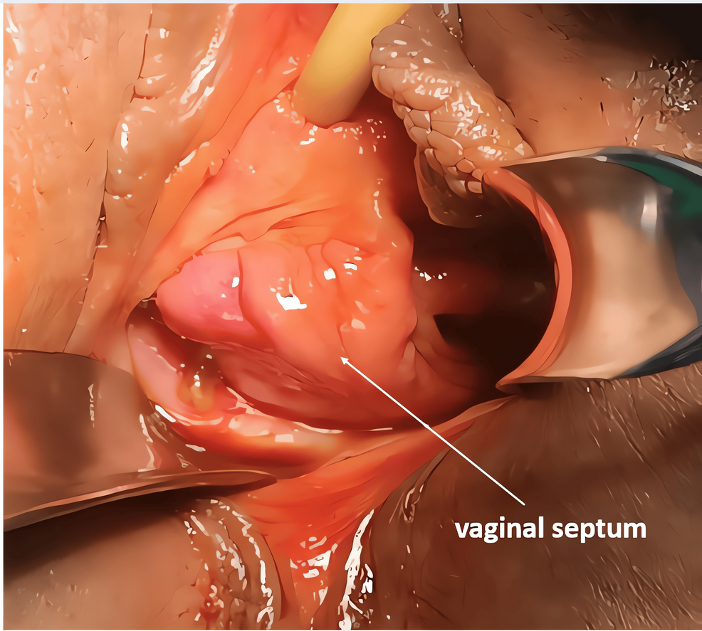 Dostimni onlayn uyquga qoying Porno rasmlarda gozalliklar