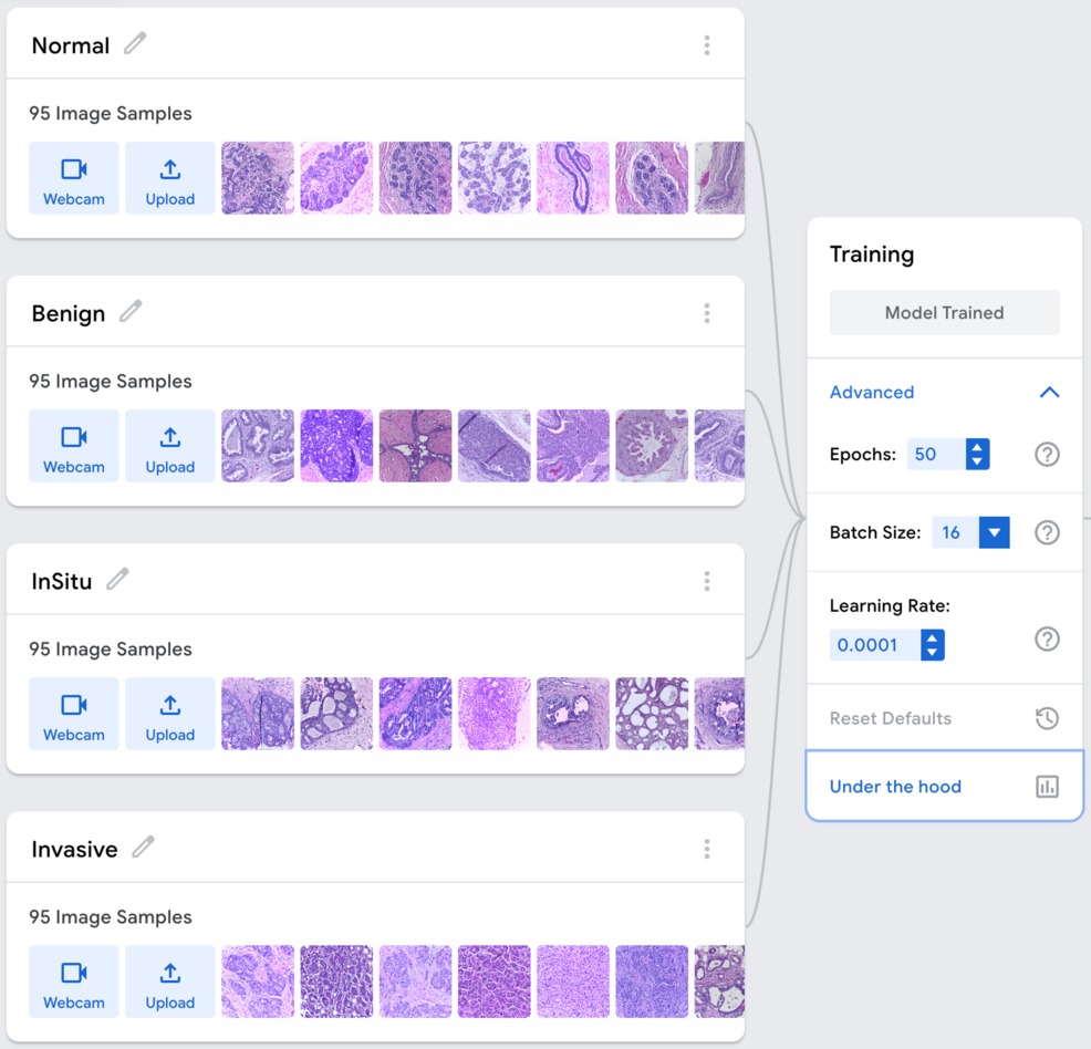 A Pilot Study of Breast Cancer Histopathological Image Classification Using  Google Teachable Machine: A No-Code Artificial Intelligence Approach |  Cureus