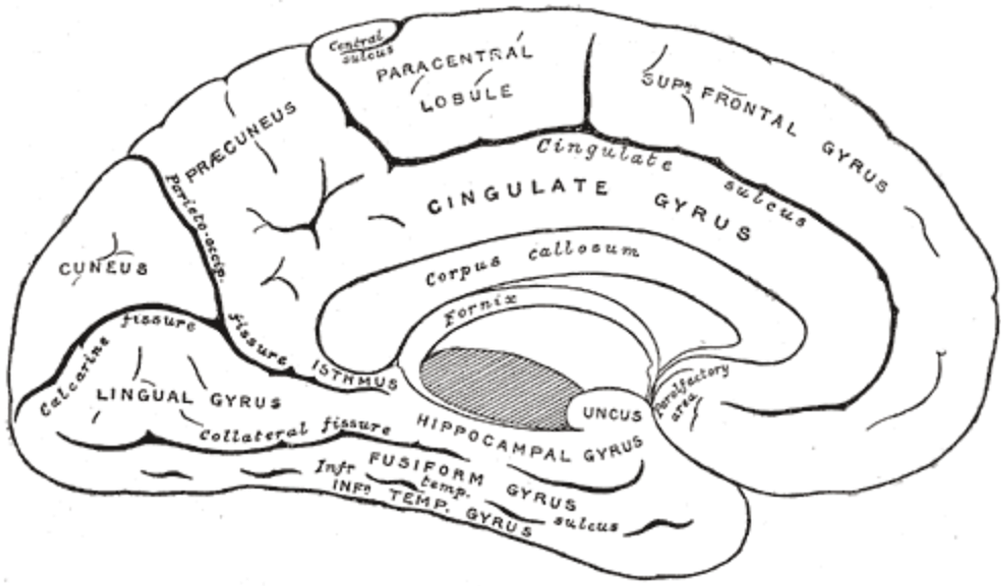 Cureus | Apperceptive Prosopagnosia Secondary to an Ischemic Infarct of ...